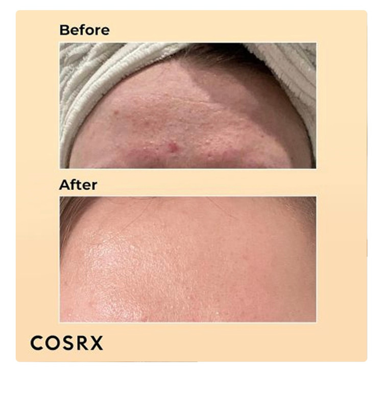 سرم حلزون اسنس COSRX Advanced Snail 96 Mucin Power Essence
