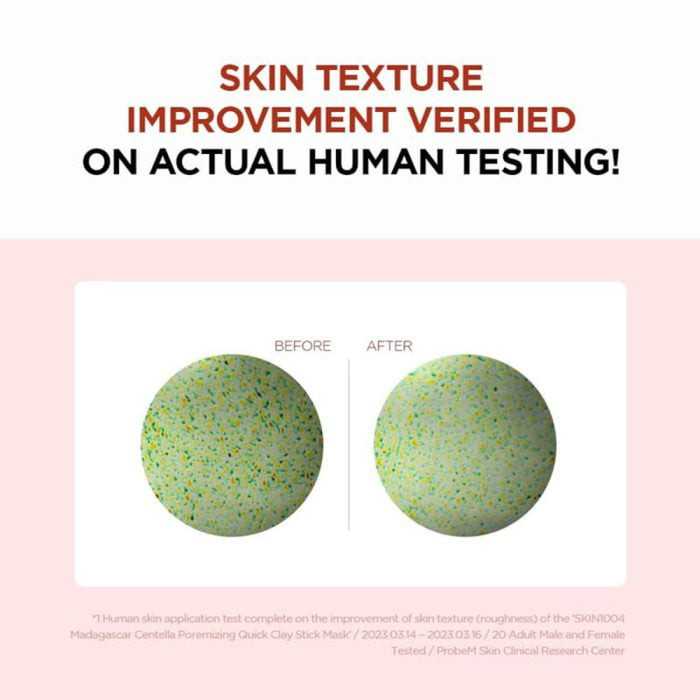 ماسک استیکی خاک رس کنترل منافذ سنتلا ماداگاسکار SKIN 1004